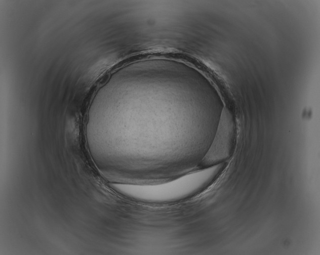 X0000090441257200708031145