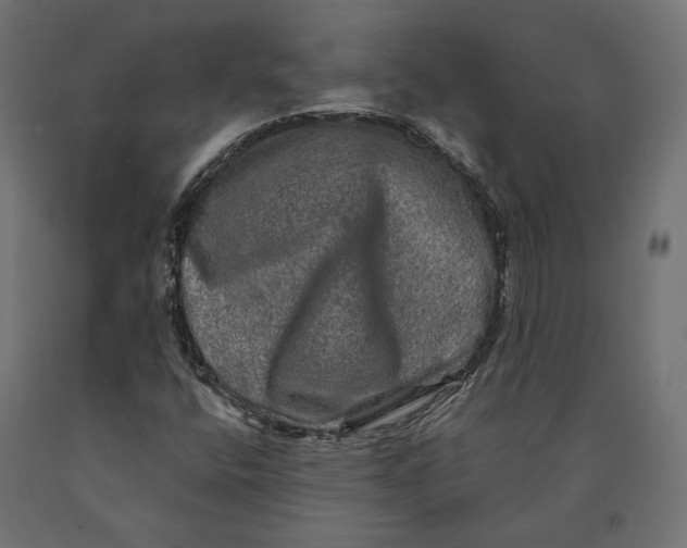 X0000090441400200708031142