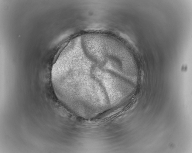X0000090441350200708102018