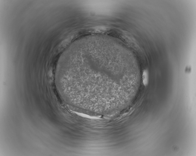 X0000090441395200708102017