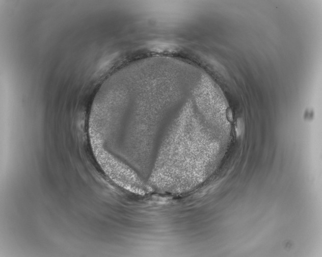 X0000090441396200708102017