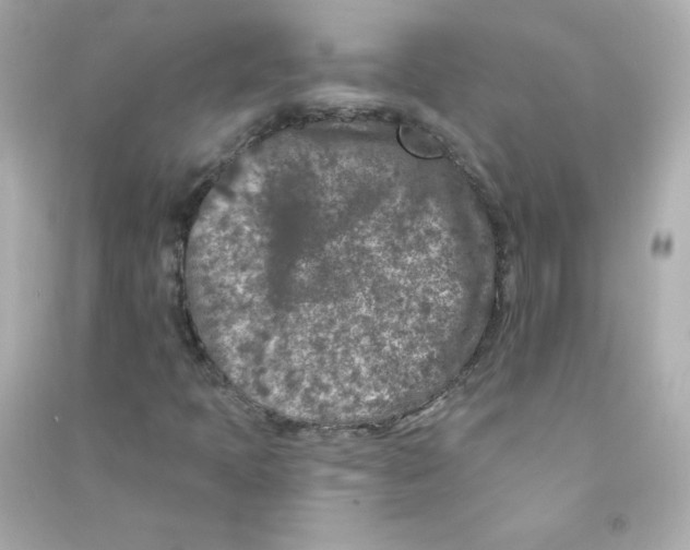 X0000090441397200708102017