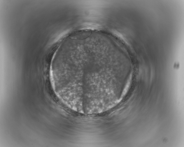 X0000090441399200708102017