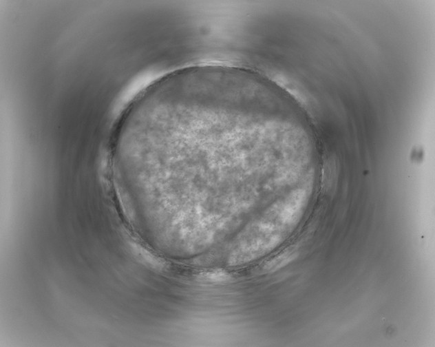 X0000090441454200708102017
