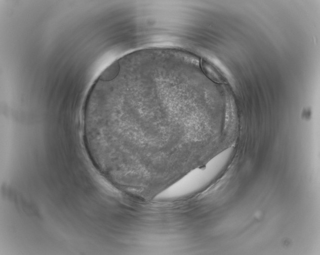 X0000090441467200708102017
