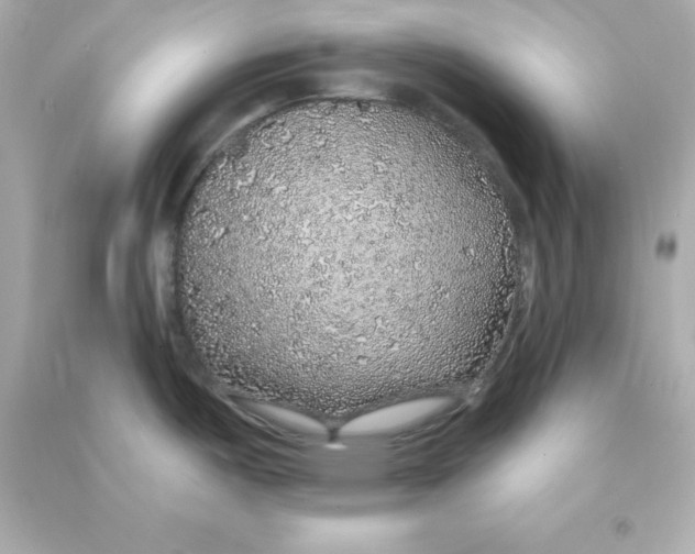 X0000090441487200708102016