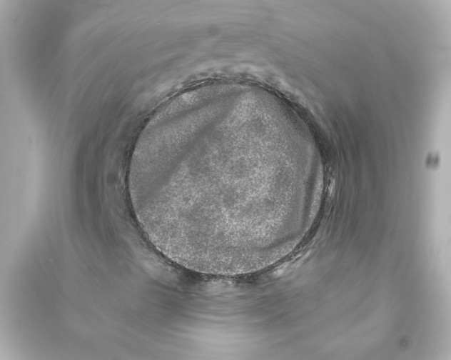 X0000090441489200708102015