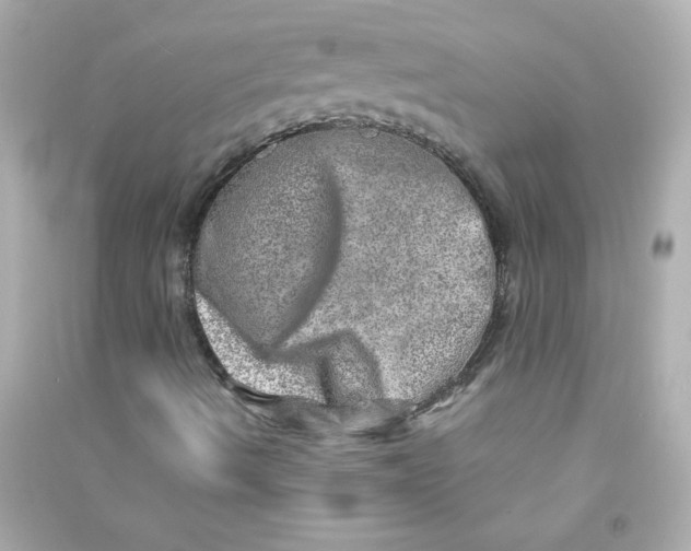 X0000090441490200708102015