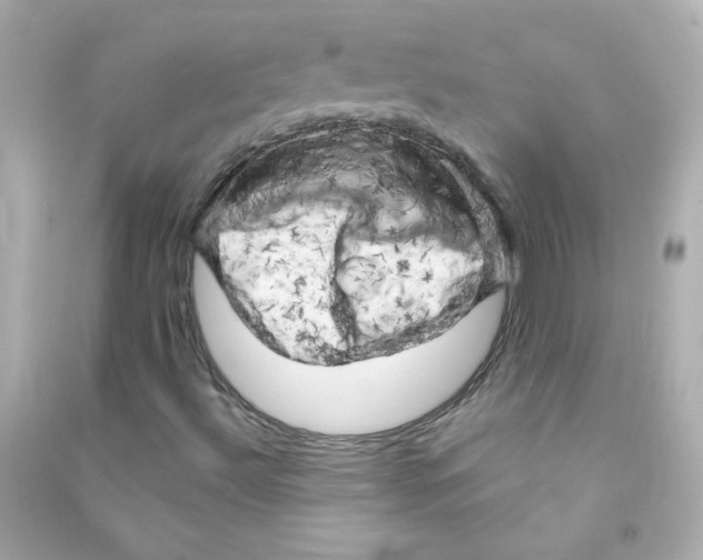 X0000090441492200708102015