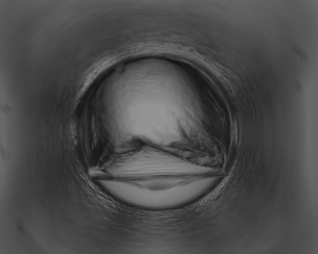 X0000090481501200708031113