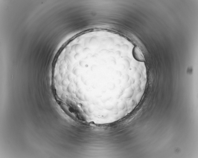X0000090481036200708102152