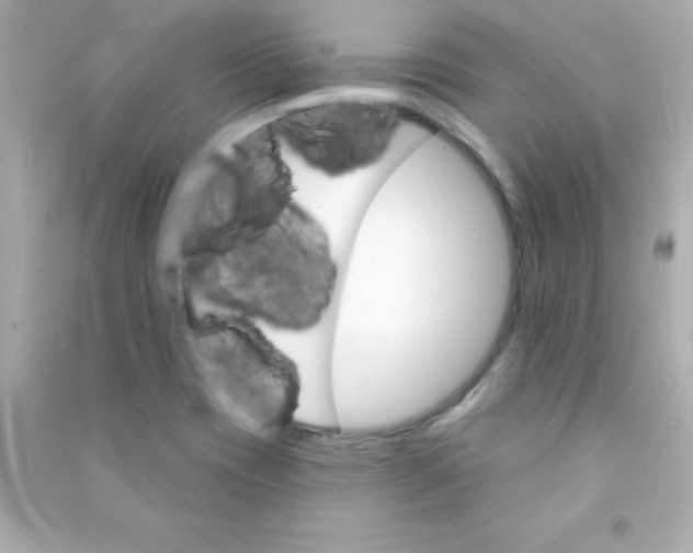 X0000090481417200708102146