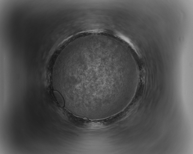 X0000090491448200707201529
