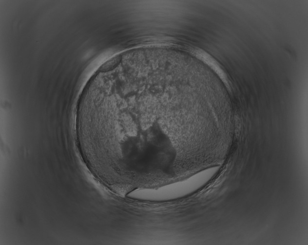 X0000090491099200708031141