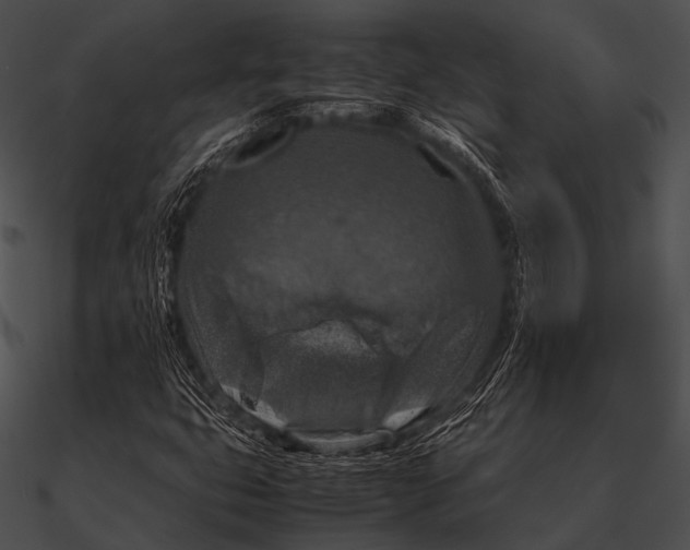 X0000090491399200708031136