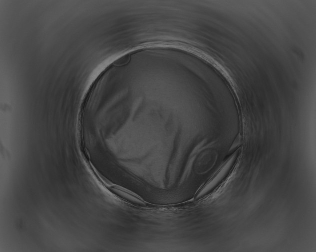 X0000090491533200708031135