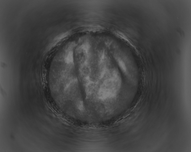 X0000090501399200708031158