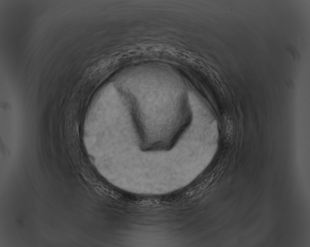 X0000090501489200708031157