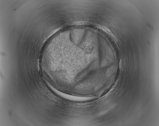 X0000090611209200708071156