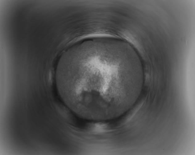 X0000090620165200707171441