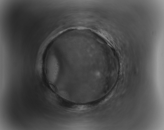 X0000090620295200707171440