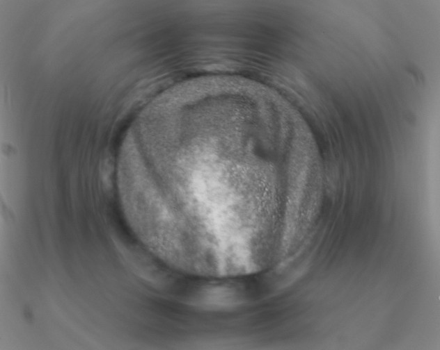 X0000090620175200708071232