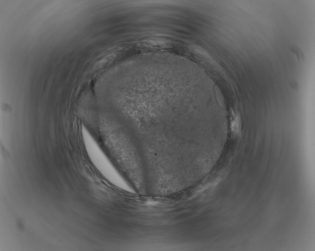 X0000090620819200708071222