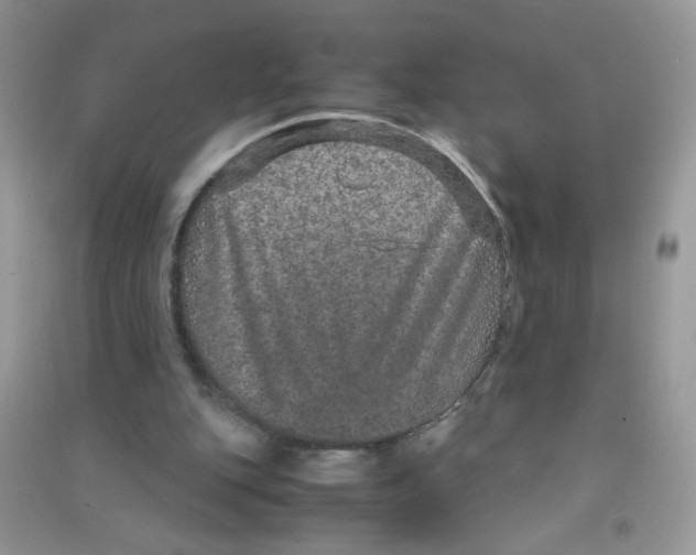 X0000090620151200708141420