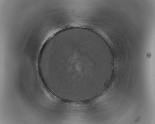 X0000090700626200708171847