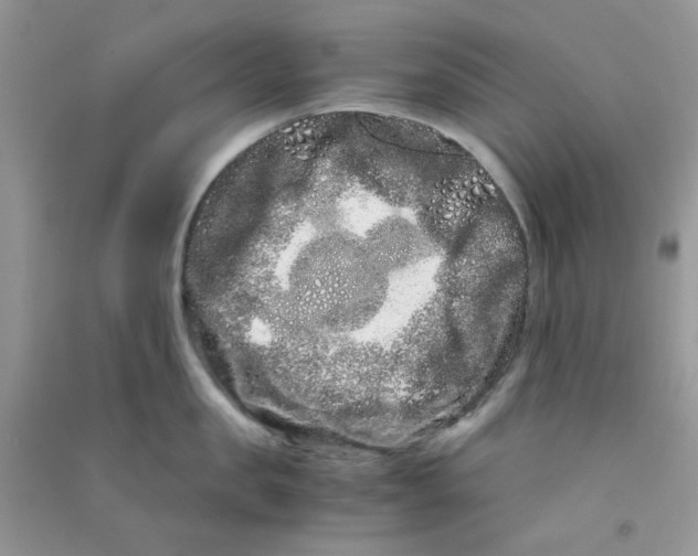 X0000090720957200708171924