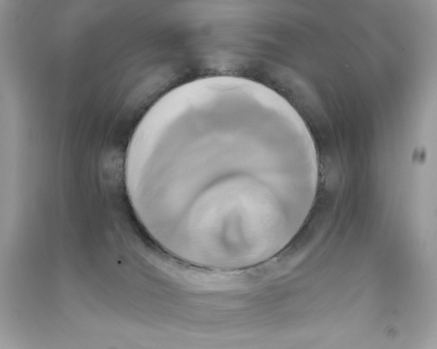 X0000090740036200708172016