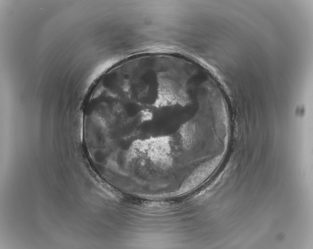 X0000090761171200708101740