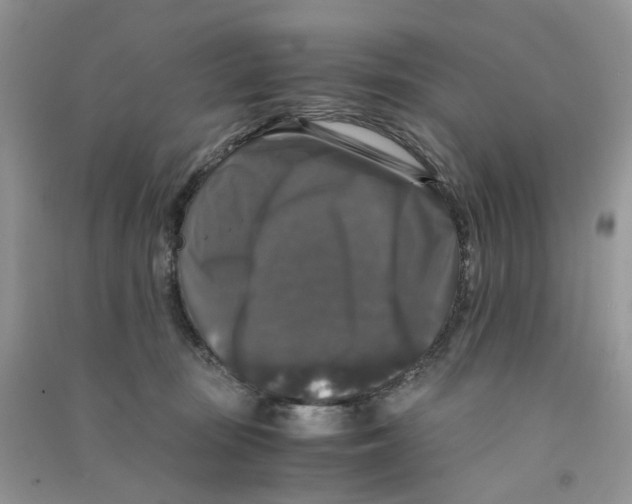 X0000090760371200708172052