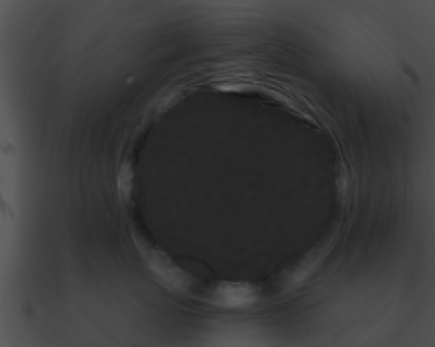 X0000090860767200708030947