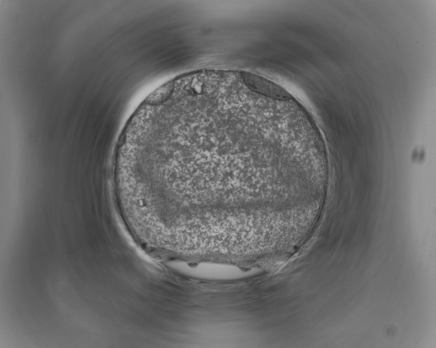 X0000090861440200708171556