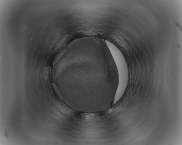 X0000091000229200708241457