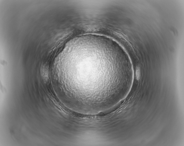 X0000091101444200708131058