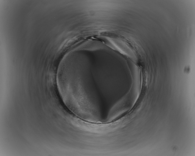 X0000091100035200708201532