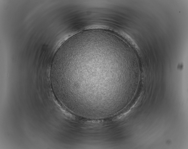 X0000091100937200708201517