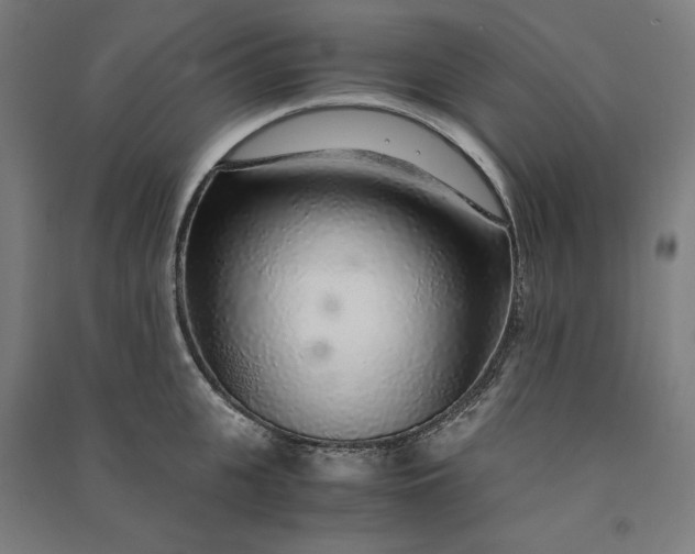 X0000091100951200708201517