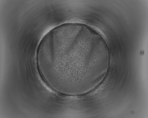 X0000091100990200708201516