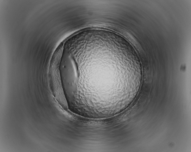 X0000091101036200708201515