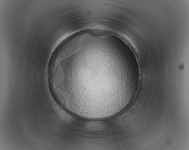 X0000091101133200708201514