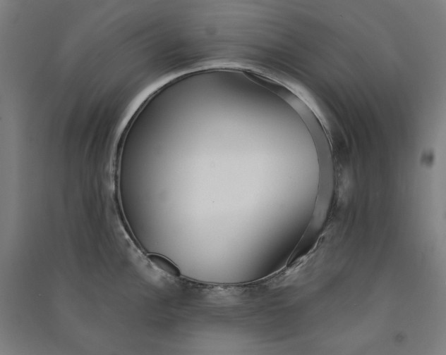 X0000091101148200708201514