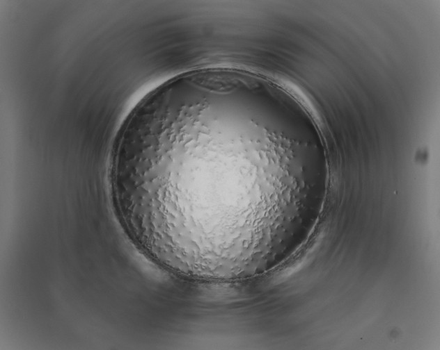 X0000091101149200708201514