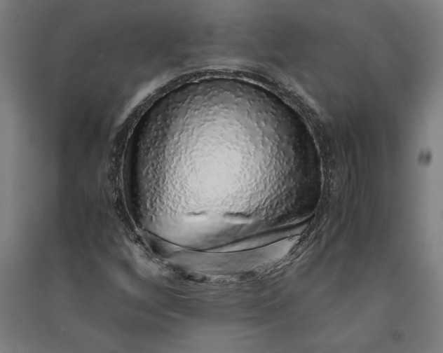 X0000091101256200708201512