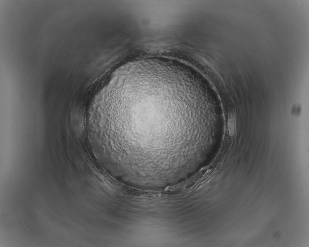 X0000091101444200708201509