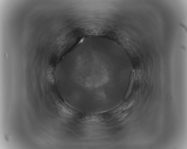 X0000091171202200708161452