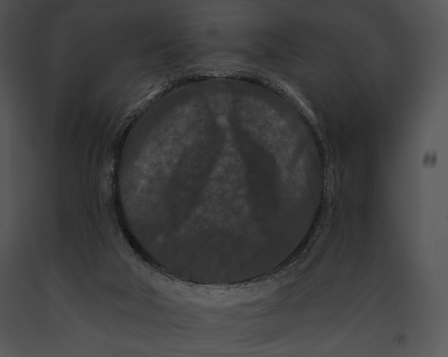 X0000091170018200708301205