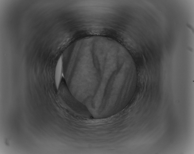 X0000091170031200709060943